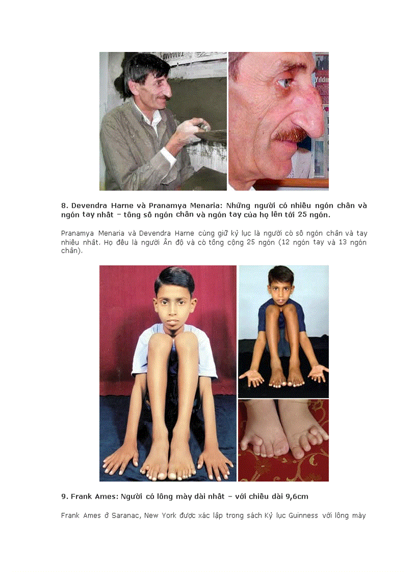 image for page 10 người sở hữu những bộ phận dị thường