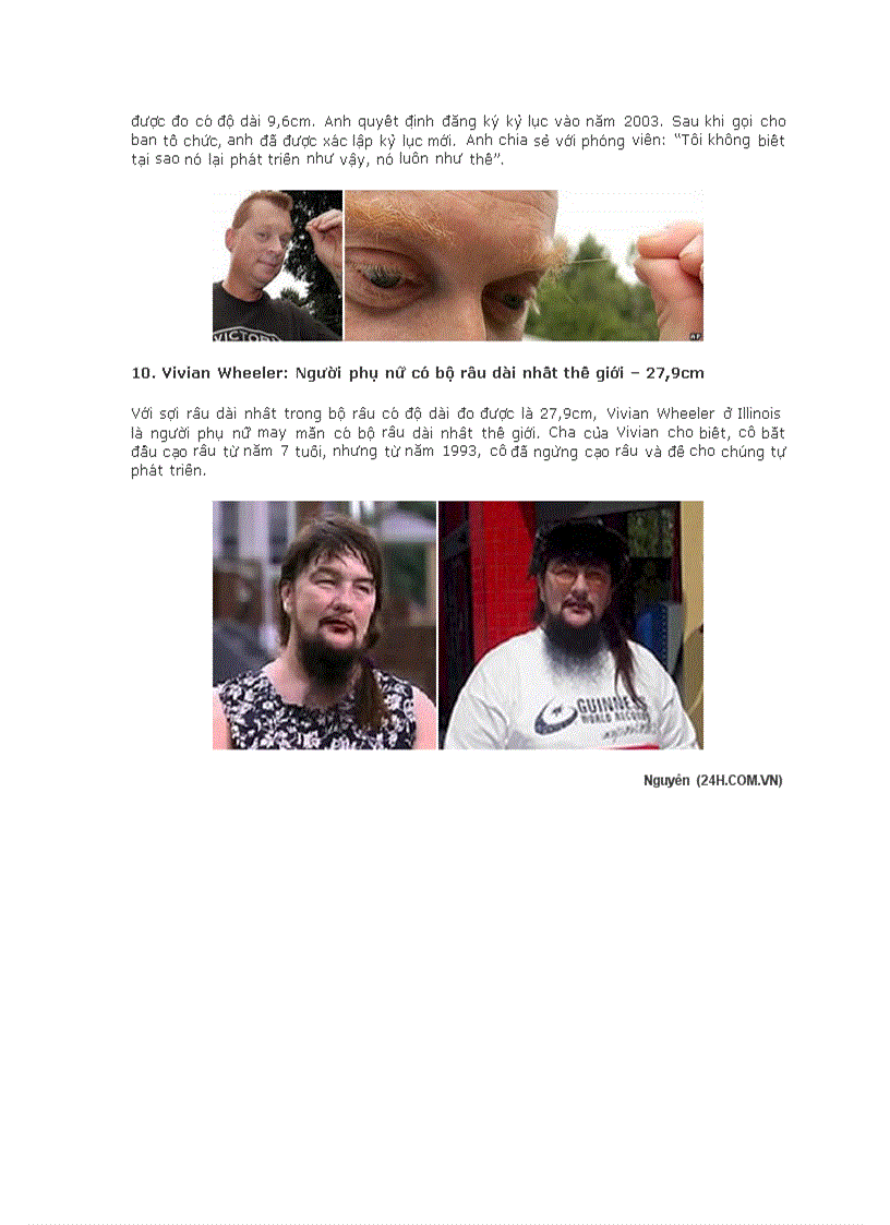 image for page 10 người sở hữu những bộ phận dị thường