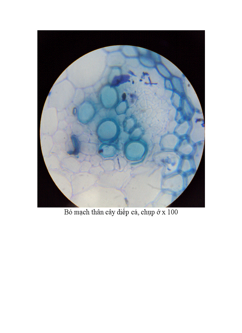 image for page Cấu tạo hiển vi của thân cây lá rễ