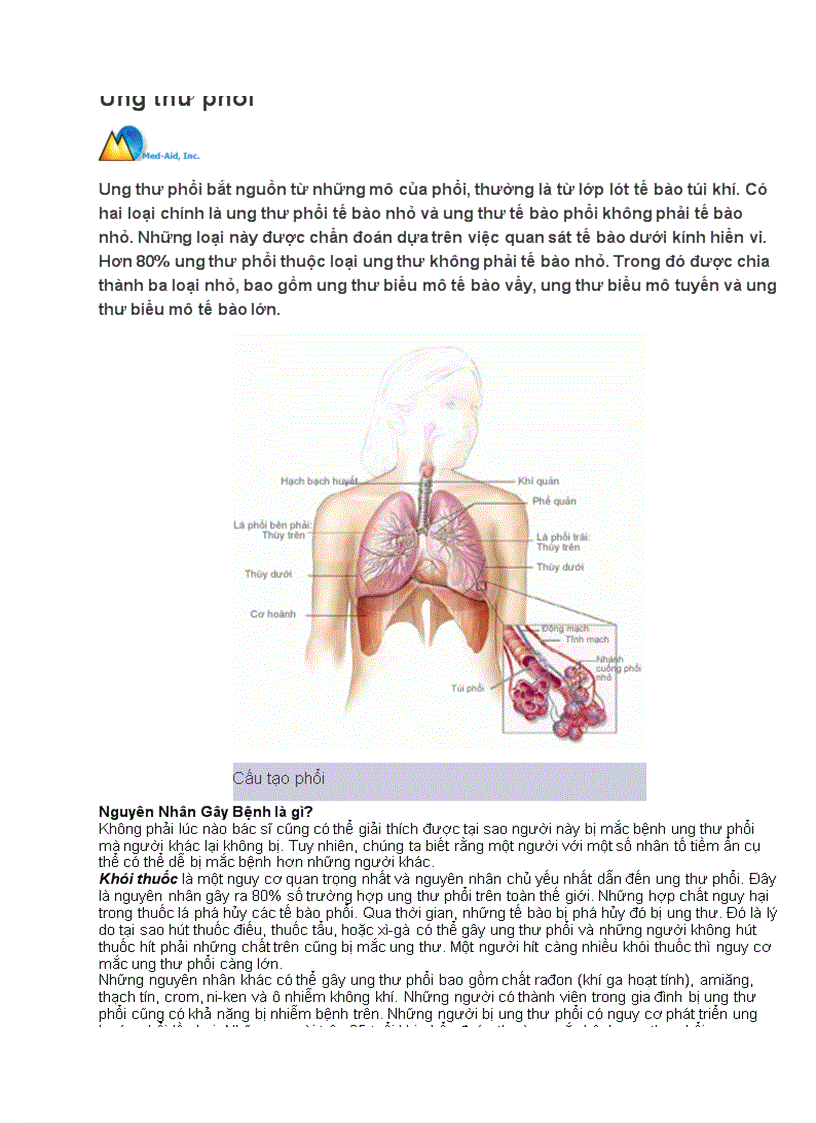Dấu hiệu Ung thư phổi