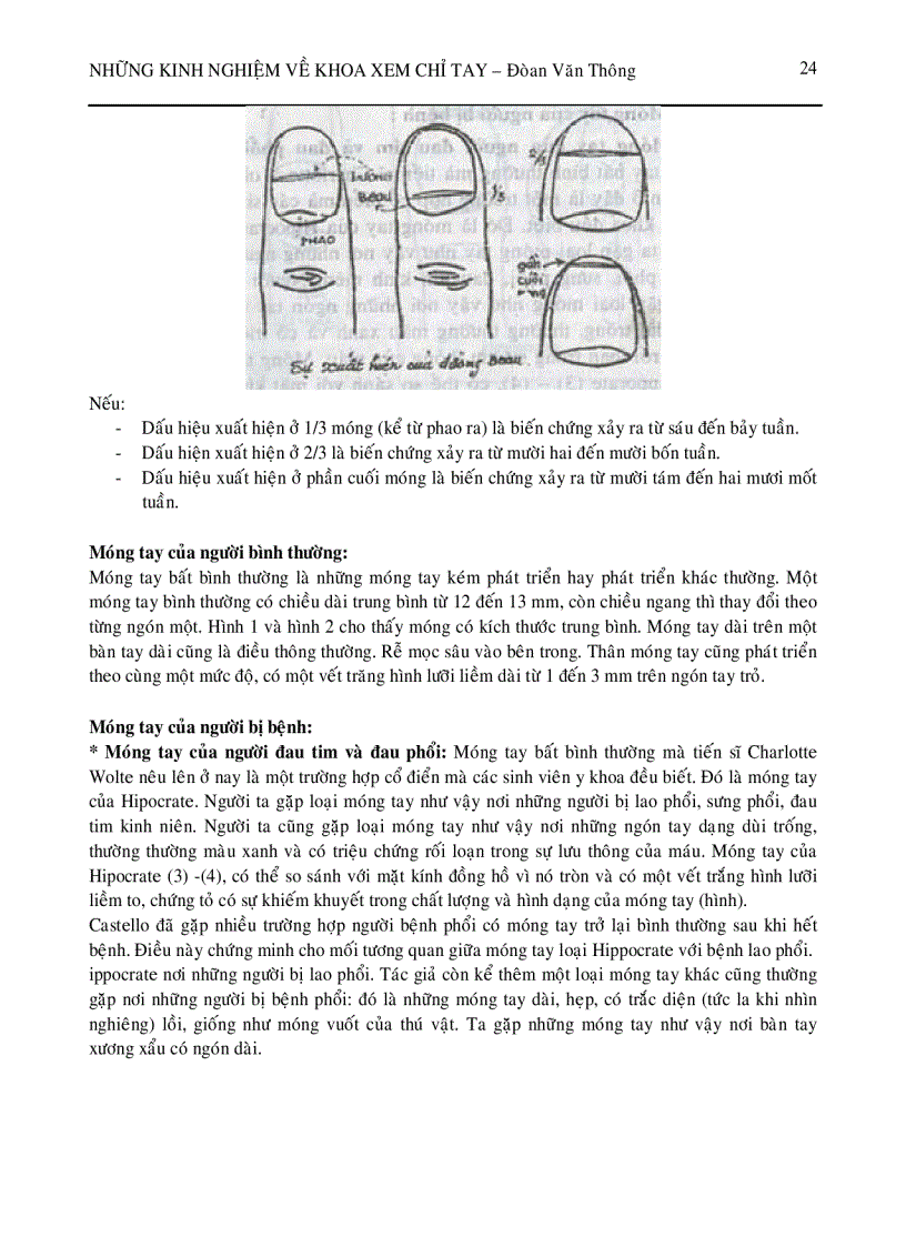 image for page Xem chỉ tay P1