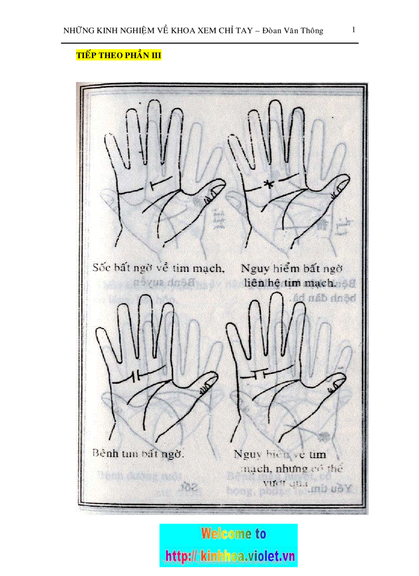 Xem chỉ tay P4