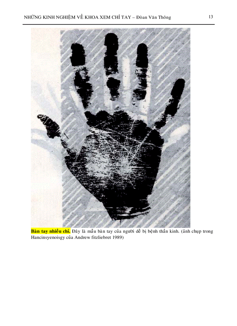 image for page Xem chỉ tay P7