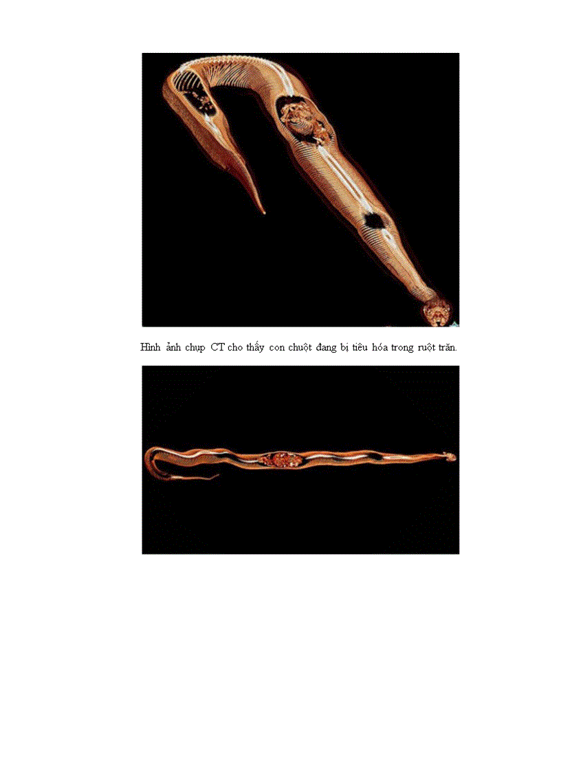 image for page Tiêu hoá của trăn