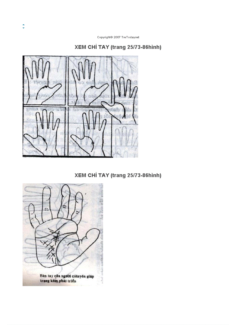 image for page Xem chi tay