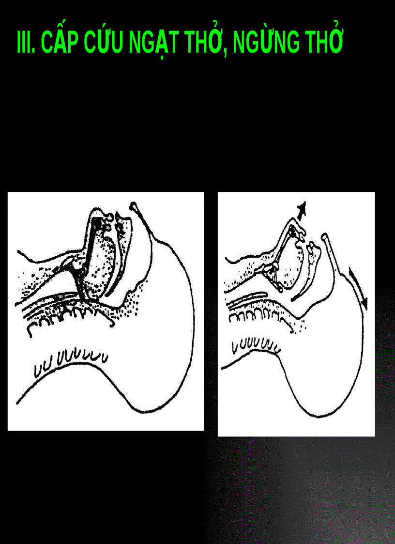 image for page Quy trình sơ cấp cứu