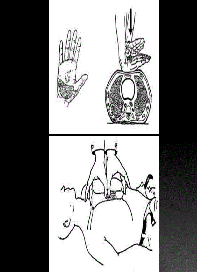 image for page Quy trình sơ cấp cứu