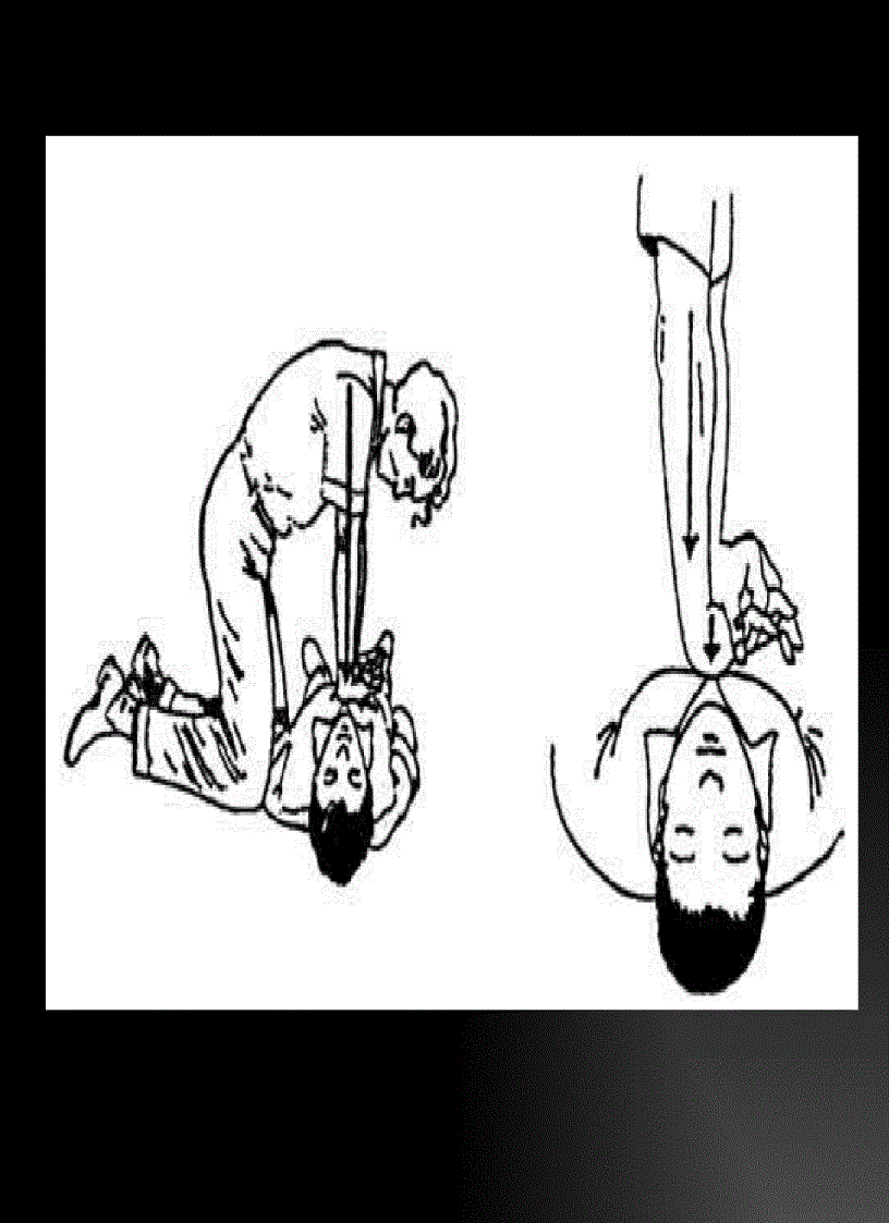 image for page Quy trình sơ cấp cứu