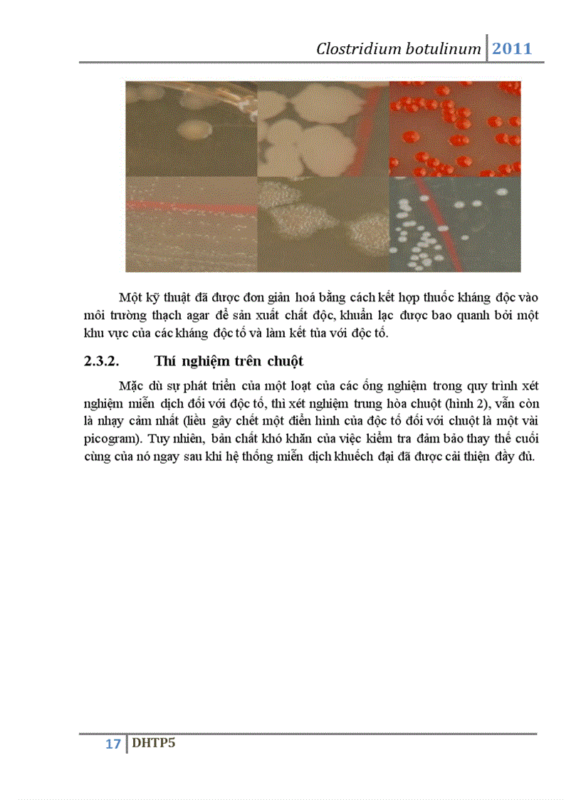 image for page Vi khuẩn Clostridium botulinum và độc tố botulin của vi khuẩn này