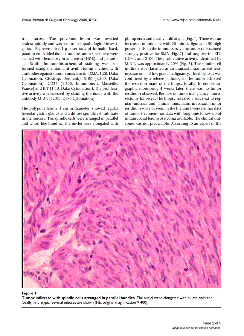 Intramucosal leiomyosarcoma of the stomach following hereditary retinoblastoma in childhood a case report and review of the literature