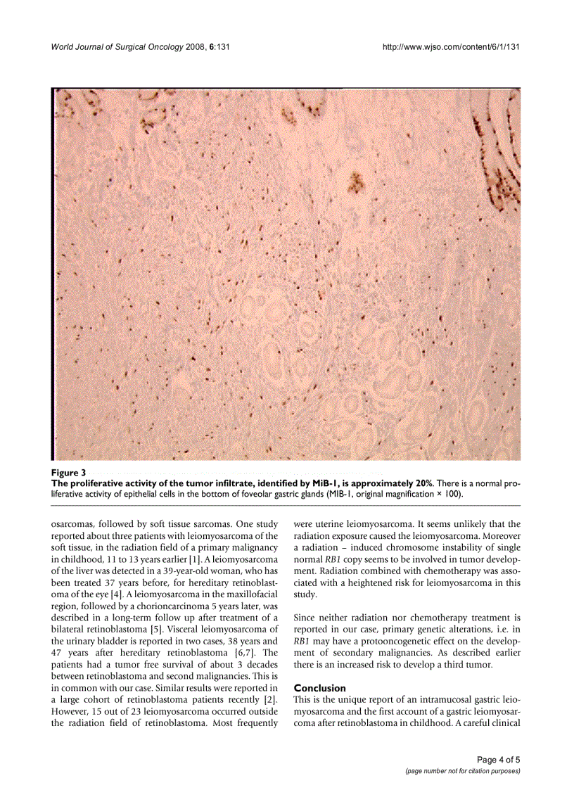 image for page Intramucosal leiomyosarcoma of the stomach following hereditary retinoblastoma in childhood a case report and review of the literature