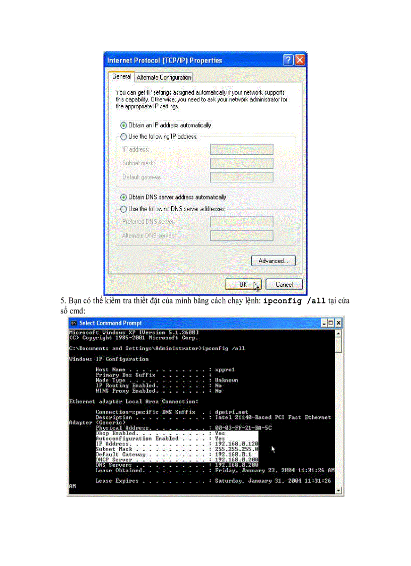 Cấu hình TCP IP để sử dụng DHCP và địa chỉ IP tĩnh cùng lúc