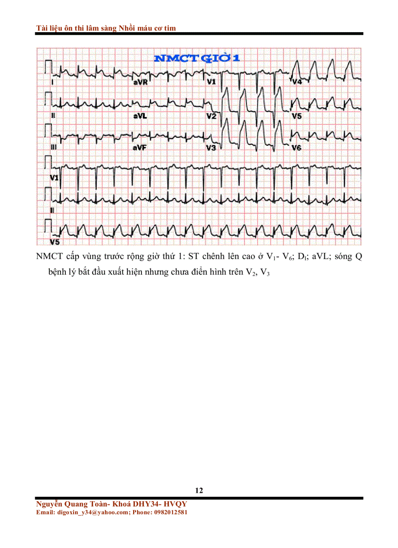 image for page Tài liệu ôn thi lâm sàng nhồi máu cơ tim