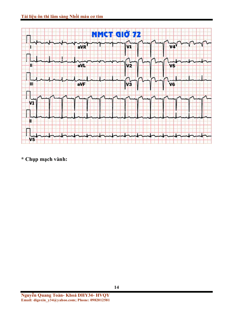 image for page Tài liệu ôn thi lâm sàng nhồi máu cơ tim