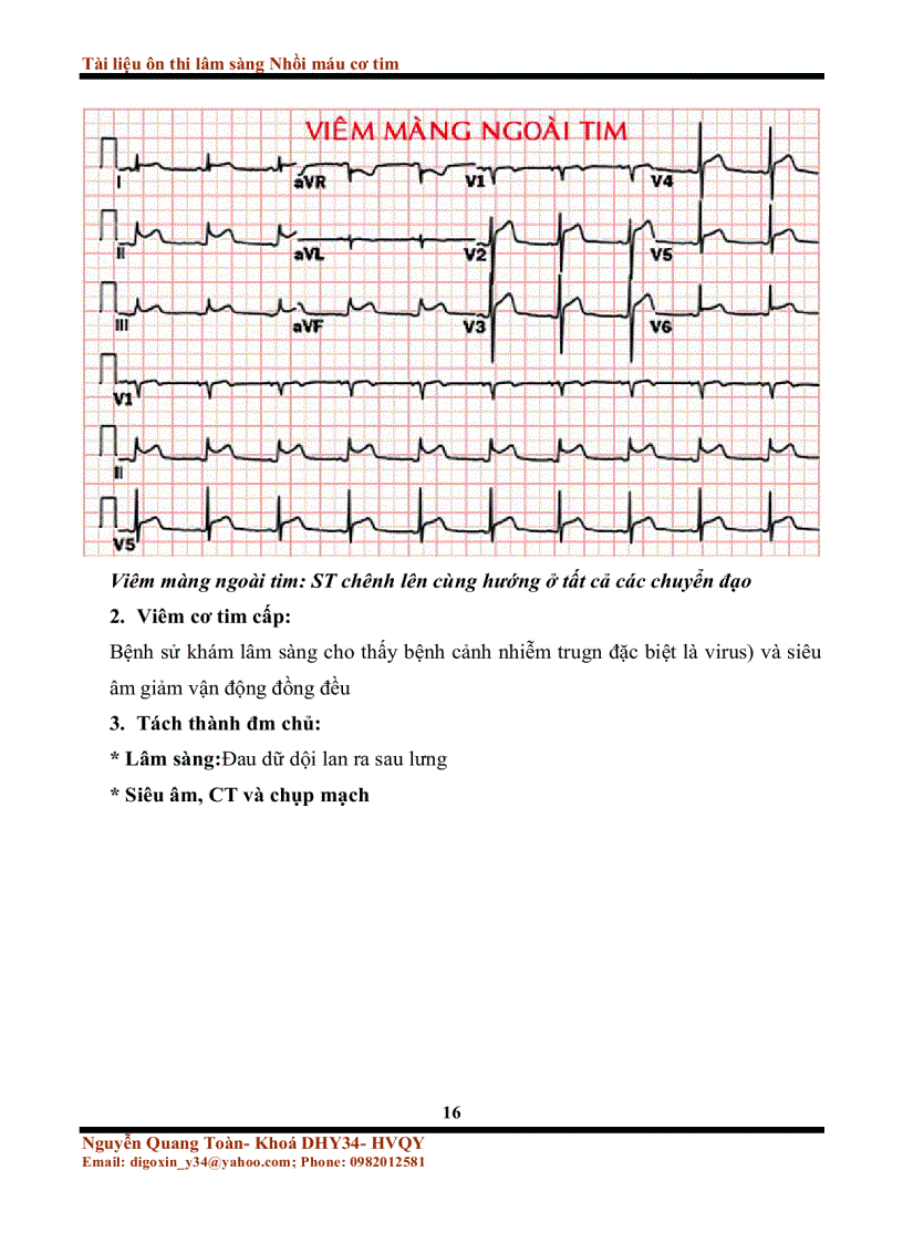 image for page Tài liệu ôn thi lâm sàng nhồi máu cơ tim