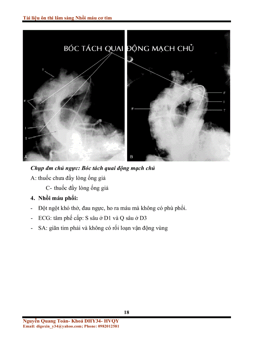 image for page Tài liệu ôn thi lâm sàng nhồi máu cơ tim