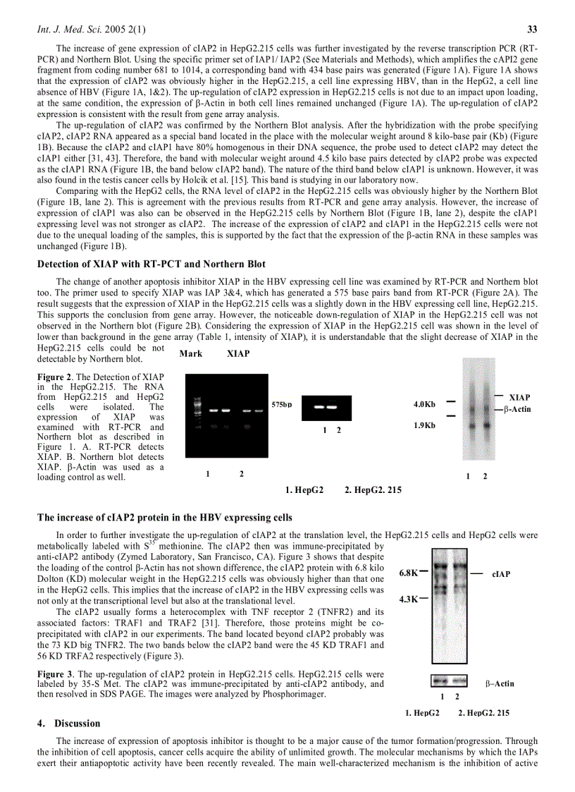 Báo cáo y học High level expression of apoptosis inhibitor in hepatoma cell line expressing Hepatitis