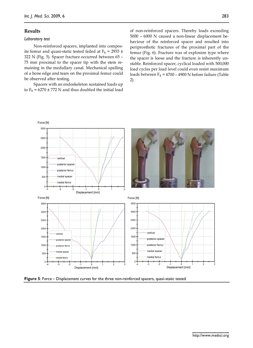 Báo cáo y học Mechanical behaviour of standardized endoskeleton including hip spacers implanted into composite femurs