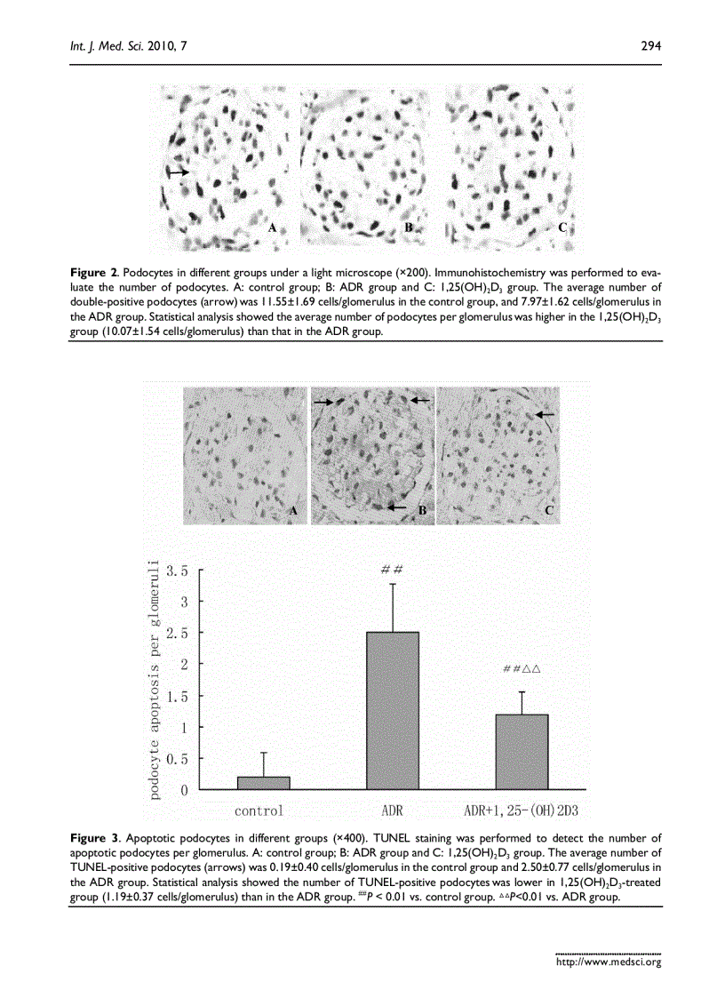 image for page Báo cáo y học 1 25 dihydroxyvitamin D3 decreases adriamycin induced podocyte apoptosis and loss
