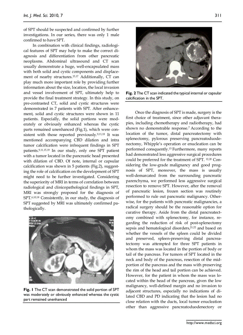 image for page Báo cáo y học Clinical Strategy for the Management of Solid Pseudopapillary Tumor of the Pancreas Aggressive or Less