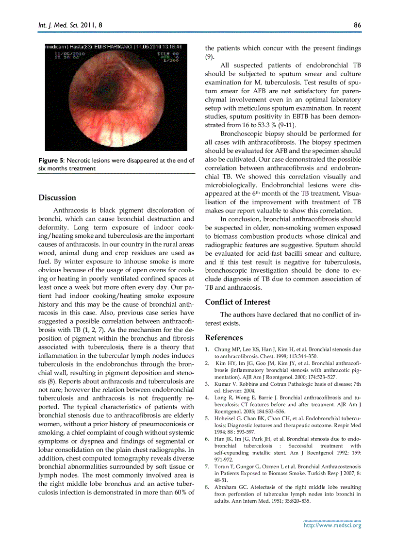 image for page Báo cáo y học Bronchial Anthracofibrosis Case with Endobronchial Tuberculosis
