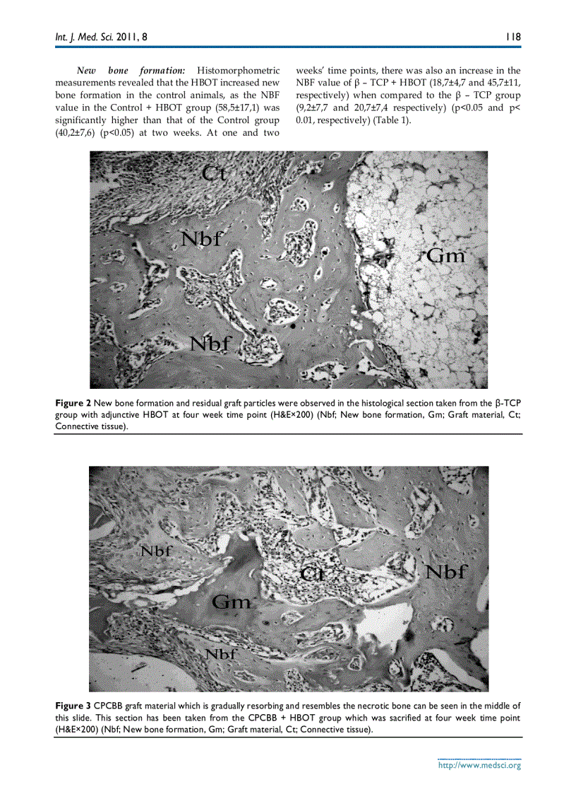 image for page Báo cáo y học The Influence of Hyperbaric Oxygen Treatment on the Healing of Experimental Defects Filled with Different Bone Graft Substitutes
