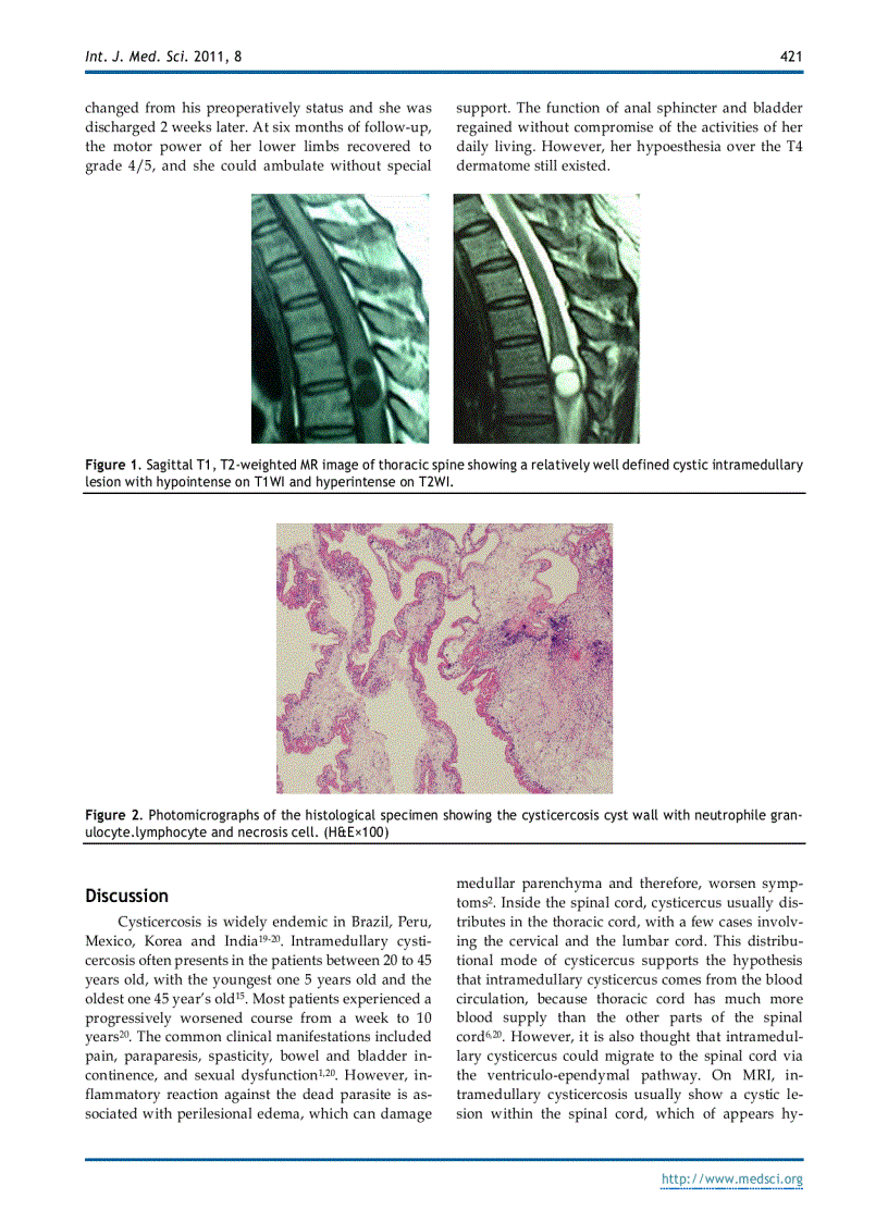 image for page Báo cáo y học Spinal Intramedullary Cysticercosis A Case Report and Literature Review