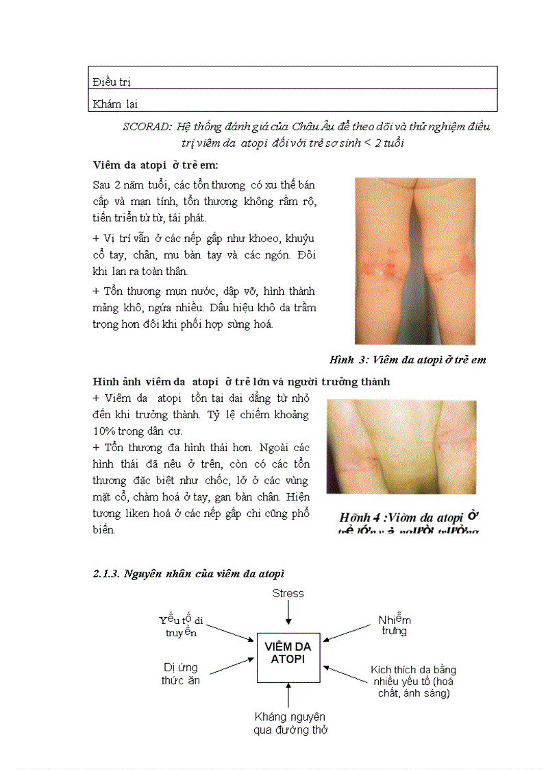image for page Viêm da atopi và viêm da dị ứng tiếp xúc