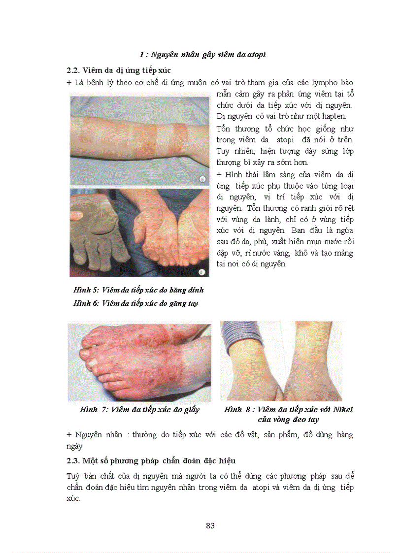 image for page Viêm da atopi và viêm da dị ứng tiếp xúc