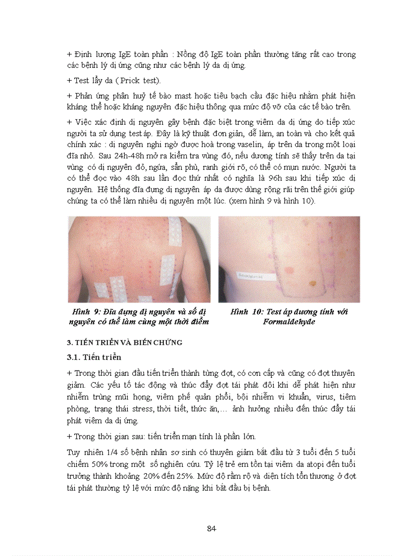 image for page Viêm da atopi và viêm da dị ứng tiếp xúc