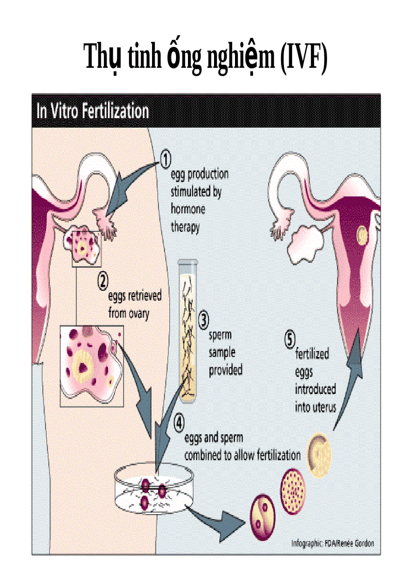 image for page Công nghệ hỗ trợ sinh sản