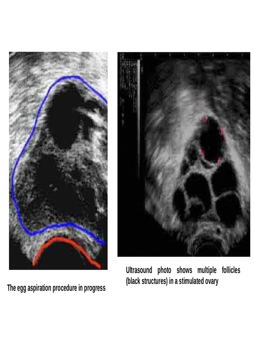 image for page Công nghệ hỗ trợ sinh sản