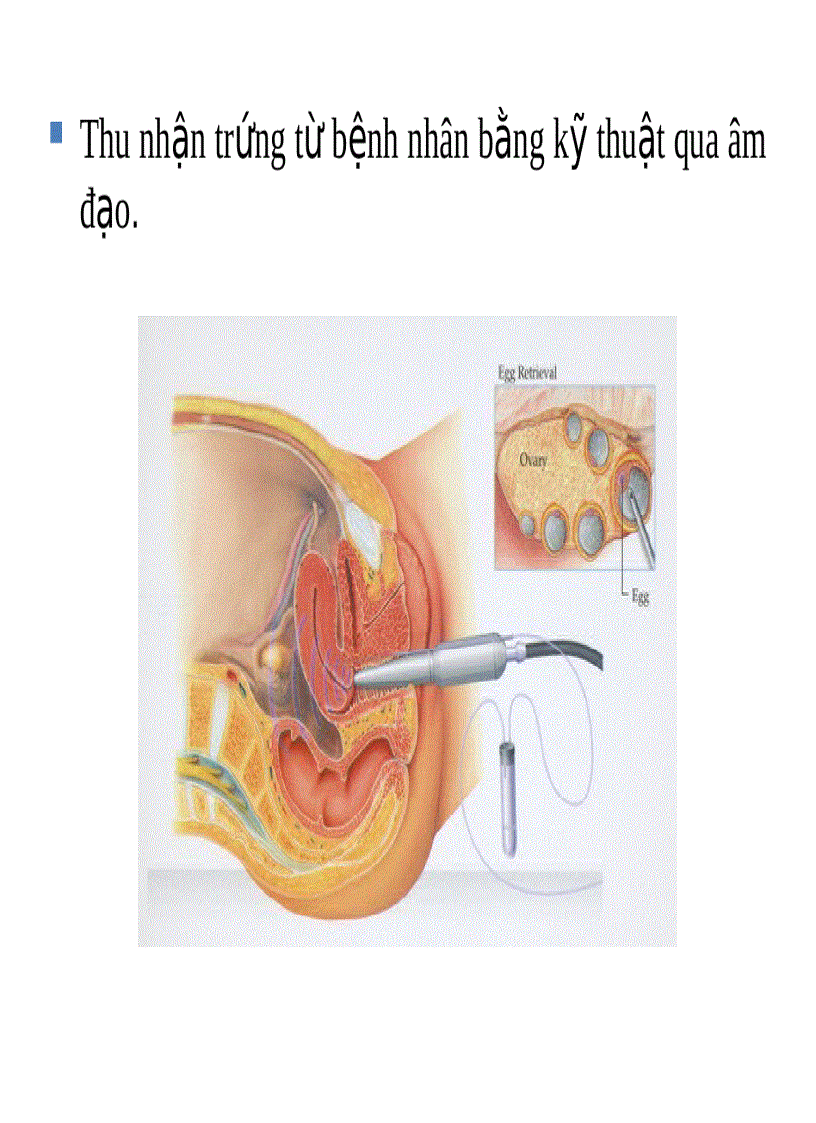 image for page Công nghệ hỗ trợ sinh sản