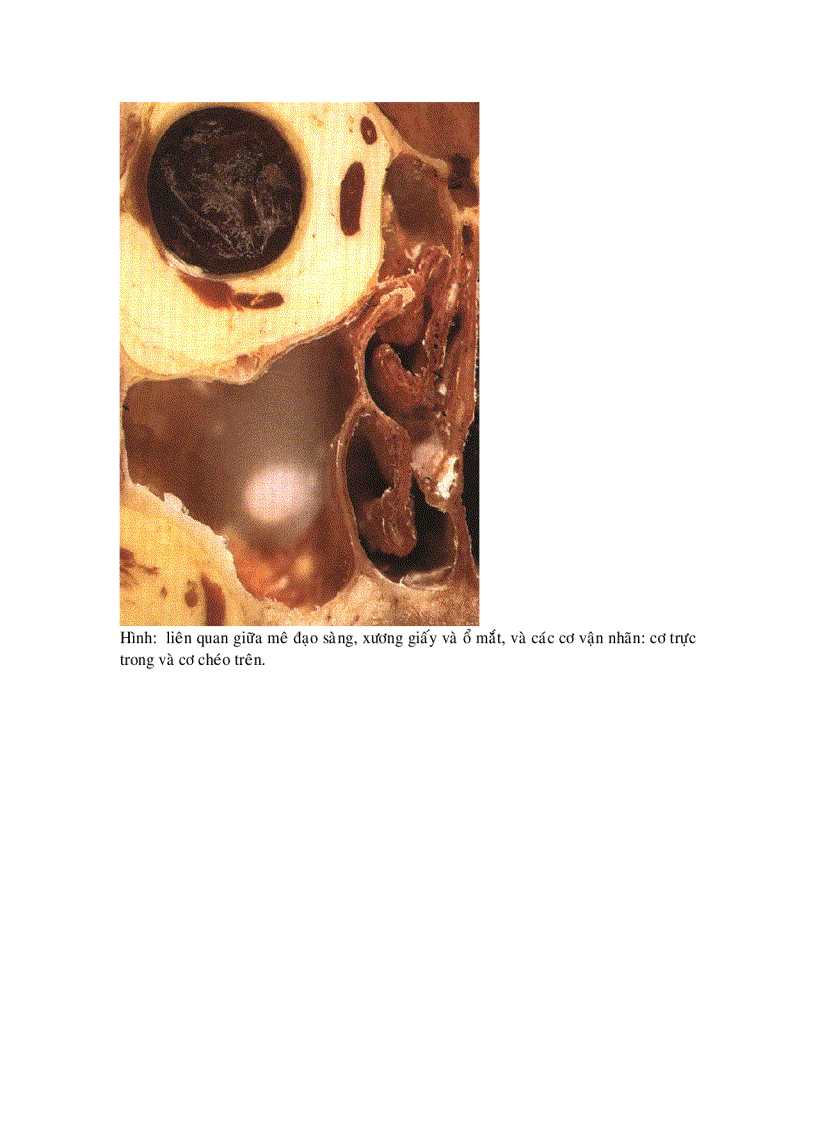 image for page Biến chứng của phẫu thuật nội soi mũi xoang