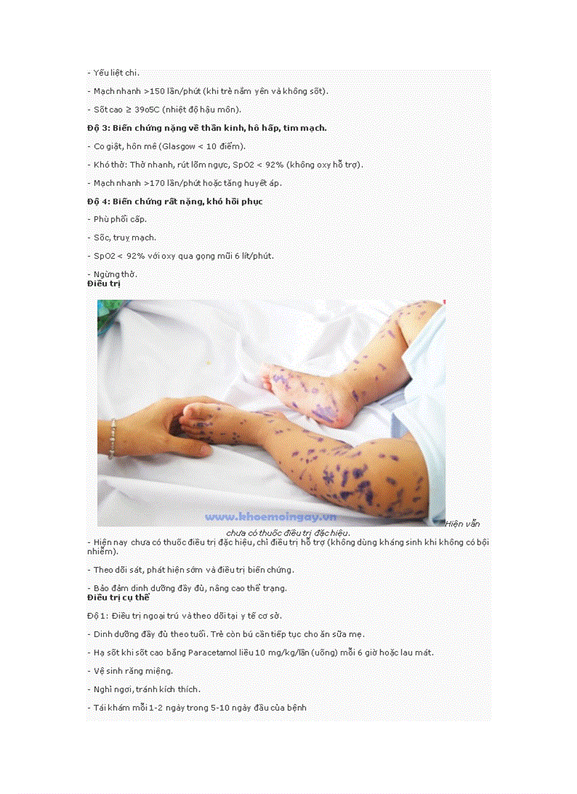 image for page Bệnh tay chân miệng