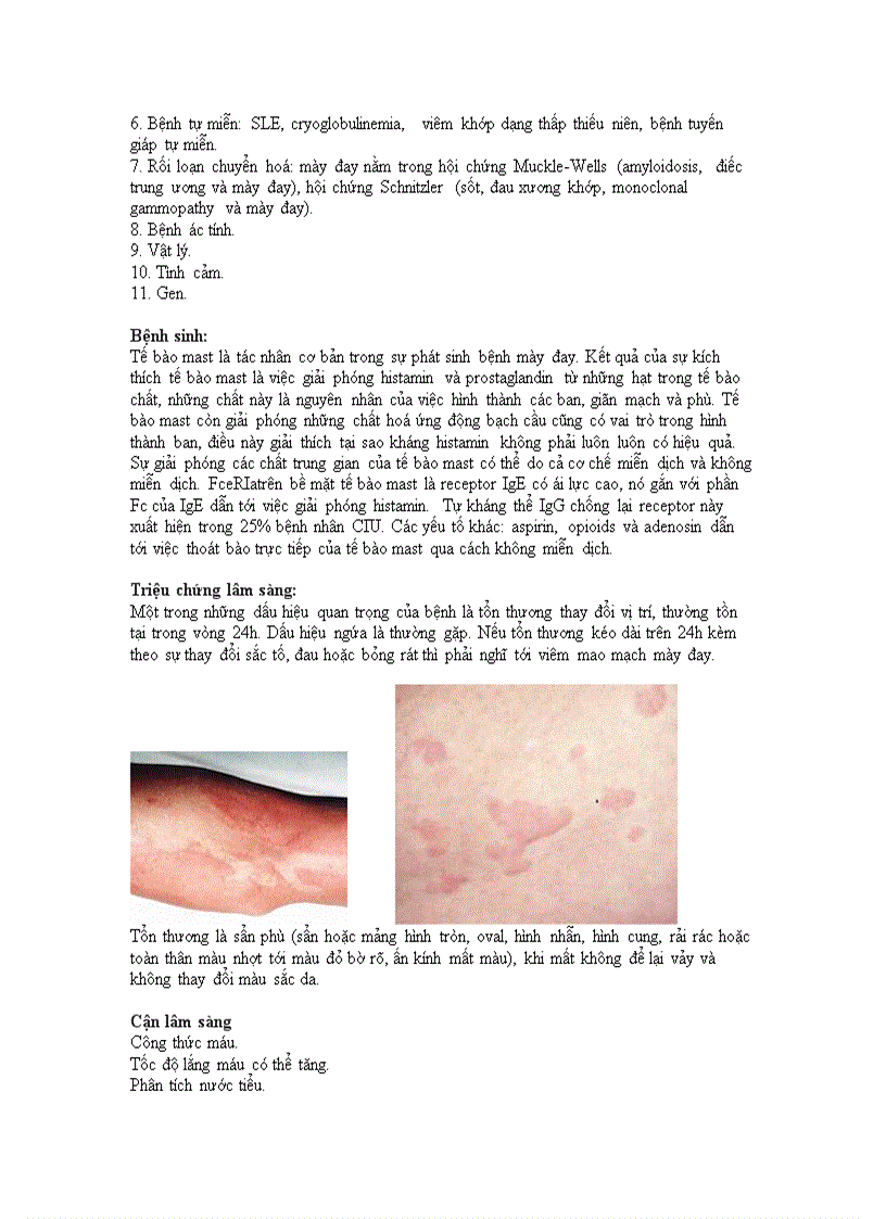 image for page Mày đay mạn tính