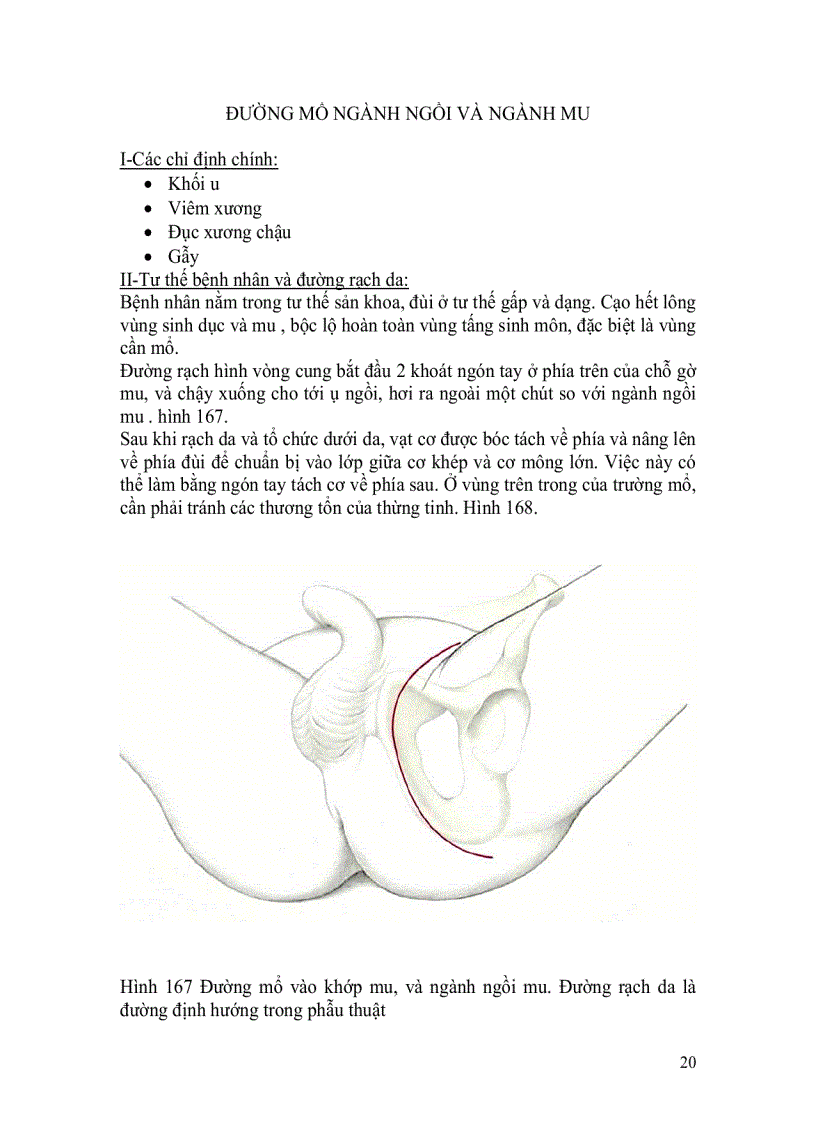 image for page Đường mổ ngành ngồi và ngành mu