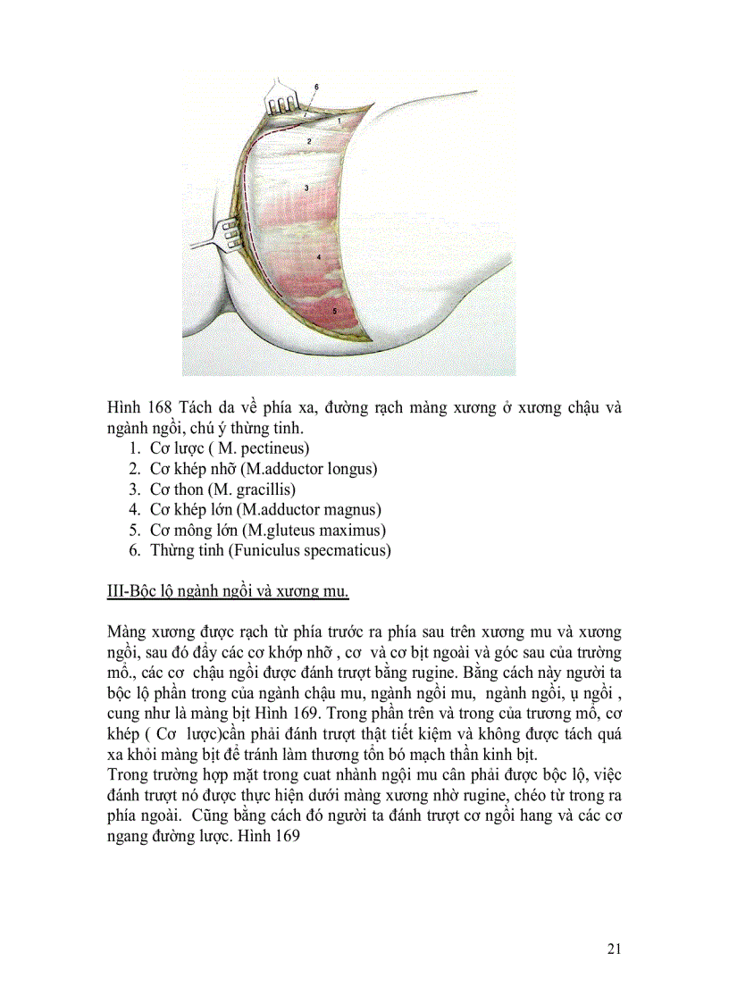 image for page Đường mổ ngành ngồi và ngành mu