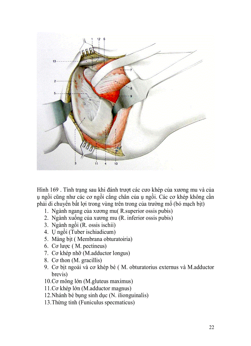 image for page Đường mổ ngành ngồi và ngành mu