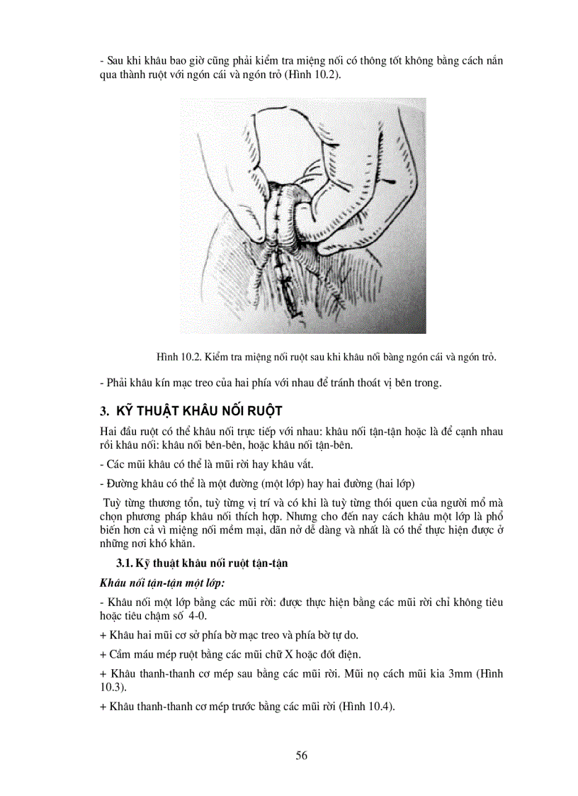 image for page Kĩ thuật khâu nối ruột