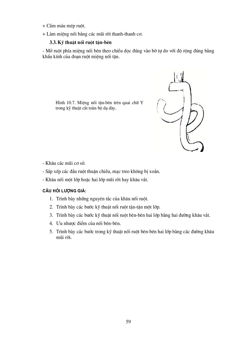 image for page Kĩ thuật khâu nối ruột