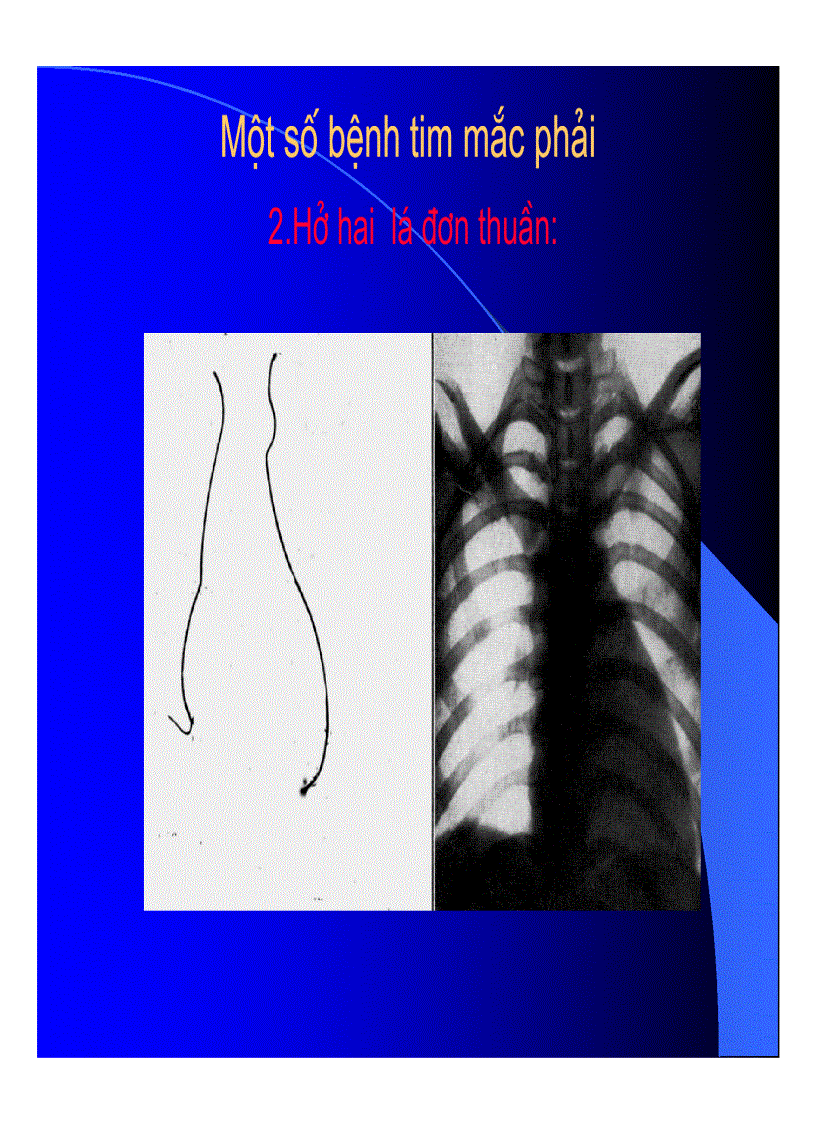 image for page Thực hành x quang trong tim mạch