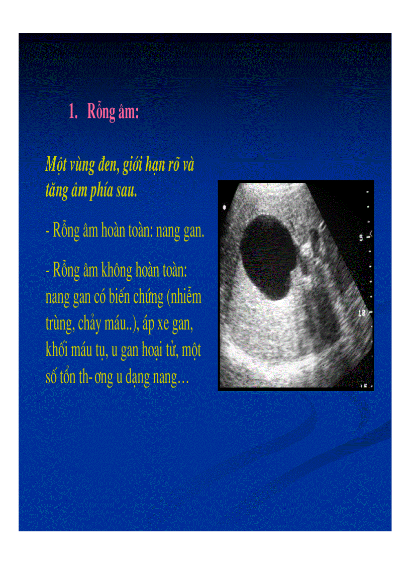 image for page Chẩn đoán hình ảnh gan mật