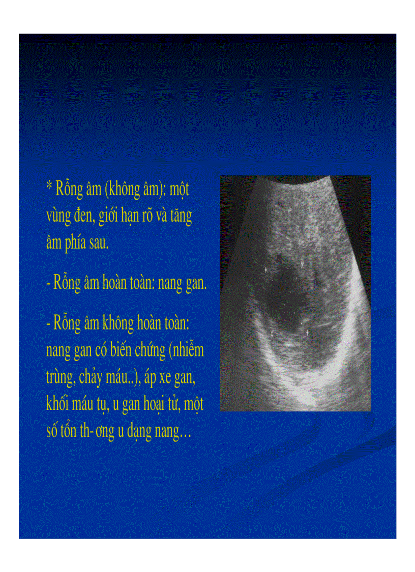 image for page Chẩn đoán hình ảnh gan mật