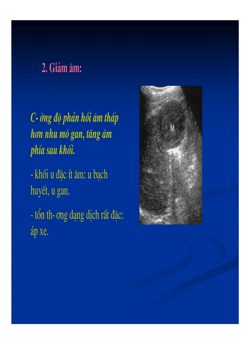 image for page Chẩn đoán hình ảnh gan mật