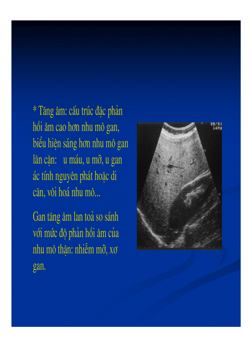 image for page Chẩn đoán hình ảnh gan mật