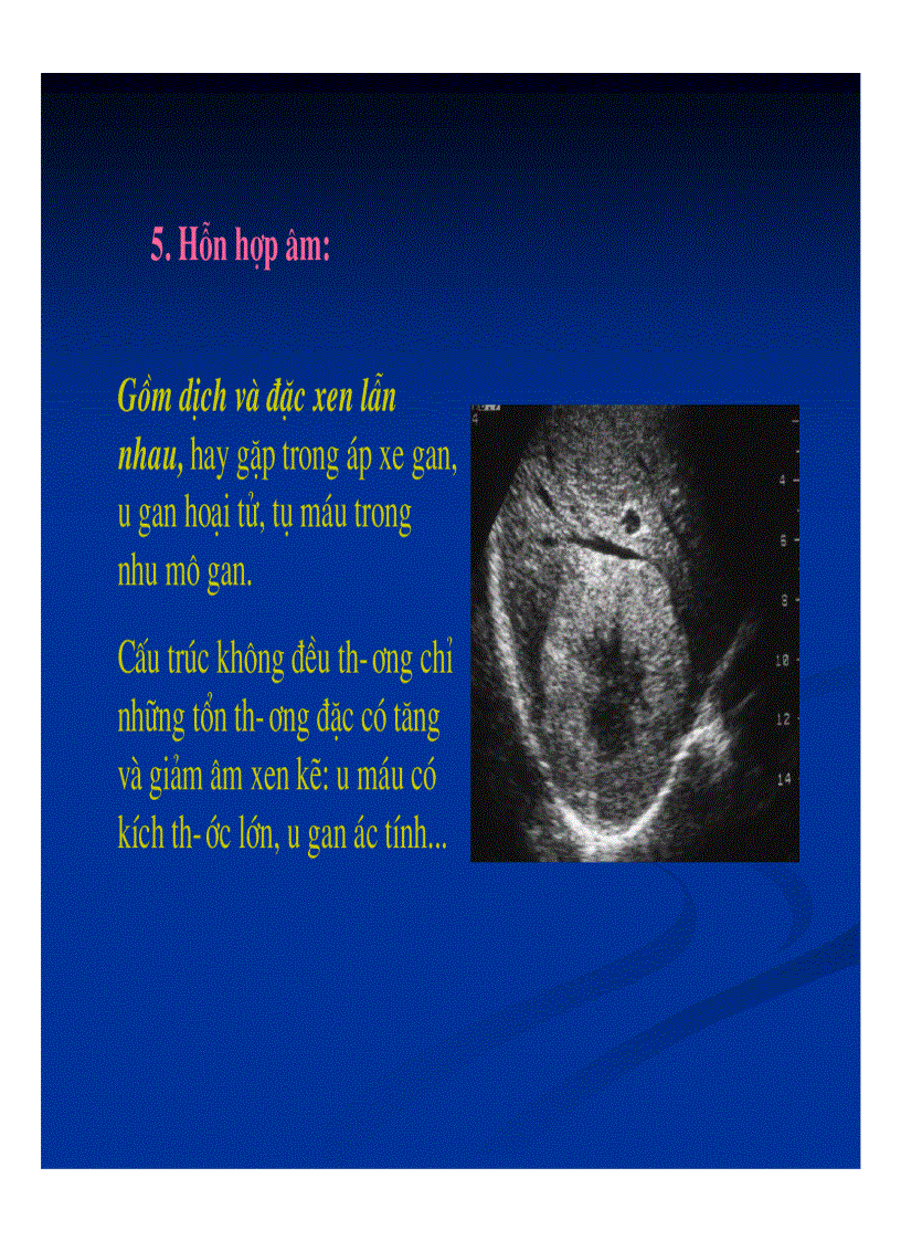 image for page Chẩn đoán hình ảnh gan mật