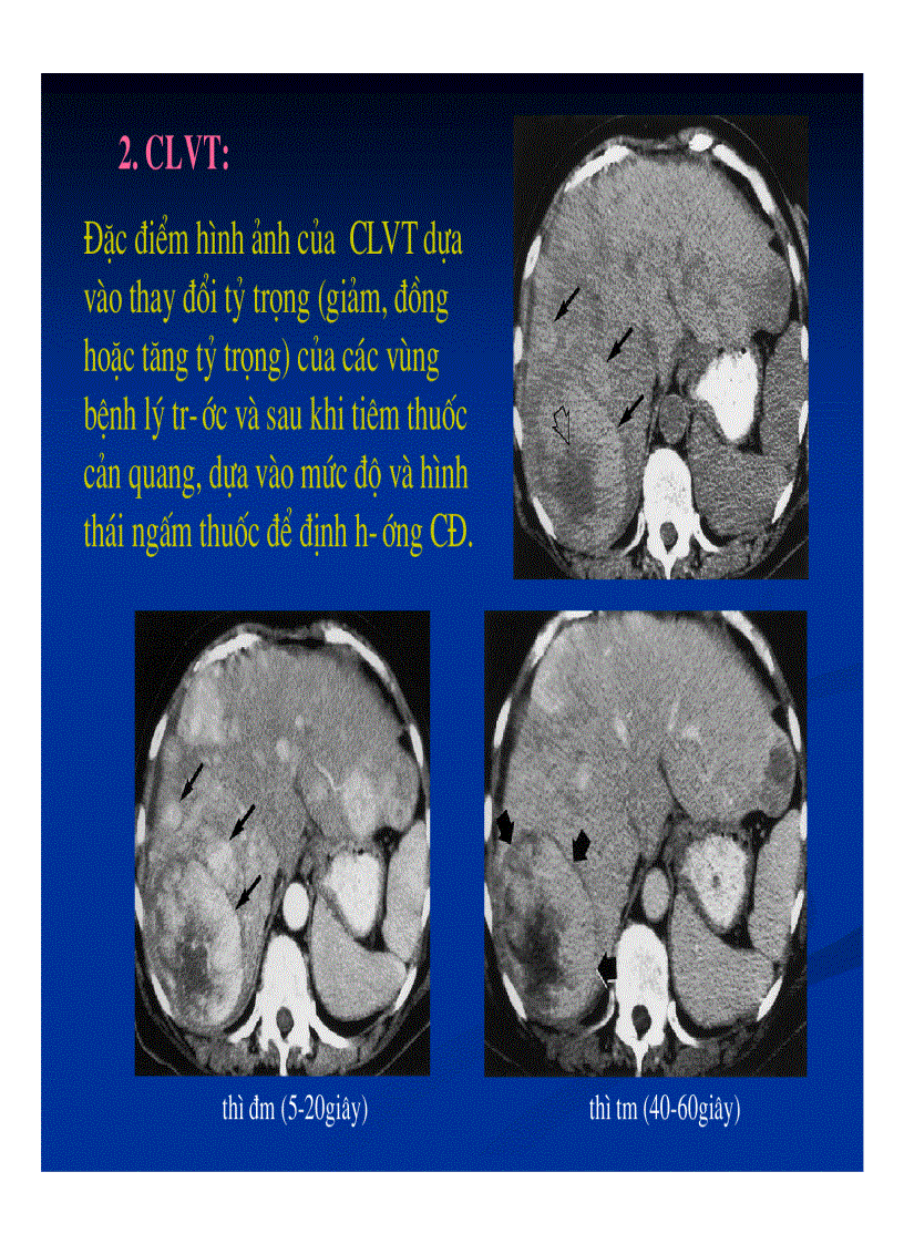 image for page Chẩn đoán hình ảnh gan mật