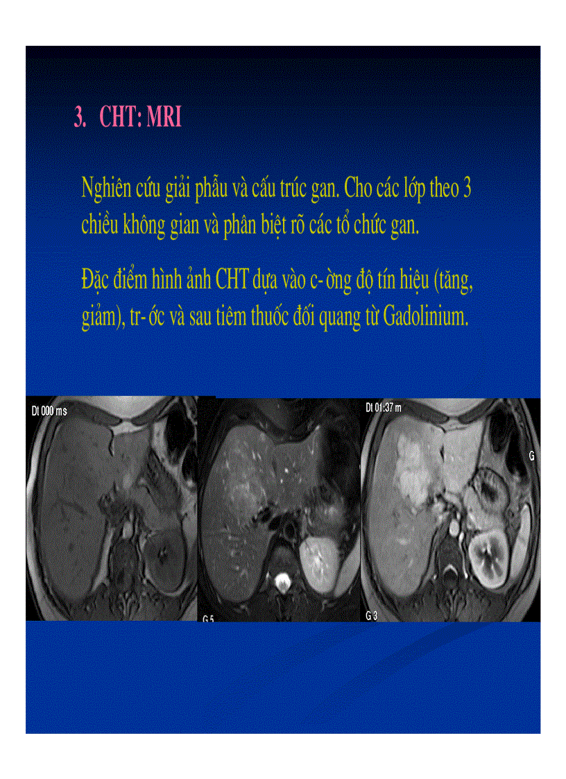 image for page Chẩn đoán hình ảnh gan mật