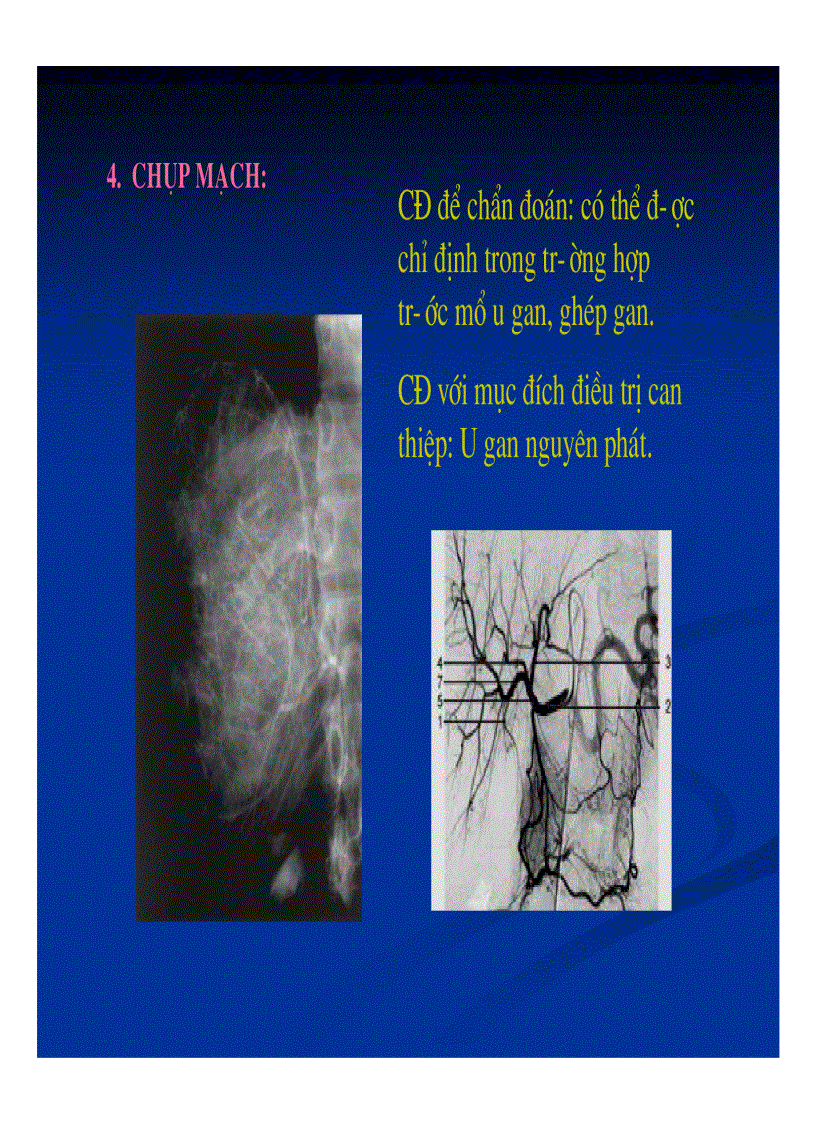 image for page Chẩn đoán hình ảnh gan mật